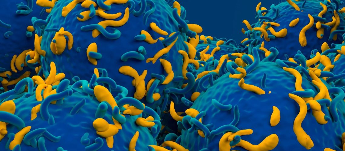 מדענים מעצבים מחדש תאי CAR-T כדי להילחם יותר מאשר בסרטן