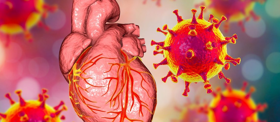 Study: Genome-wide association study of myocarditis and pericarditis following COVID-19 vaccination. Image Credit: Kateryna Kon / Shutterstock