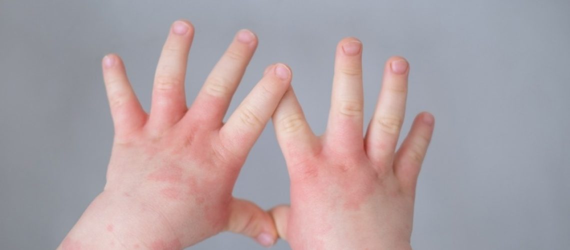 Study: Prenatal Opioid Exposure and Immune-Related Conditions in Children. Image Credit: Shevtsova Yuliya/Shutterstock.com