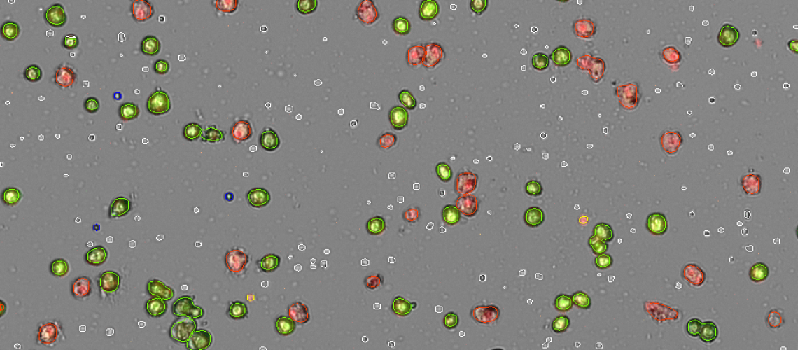 מהפכה בספירת הפטוציטים עבור חוקרים