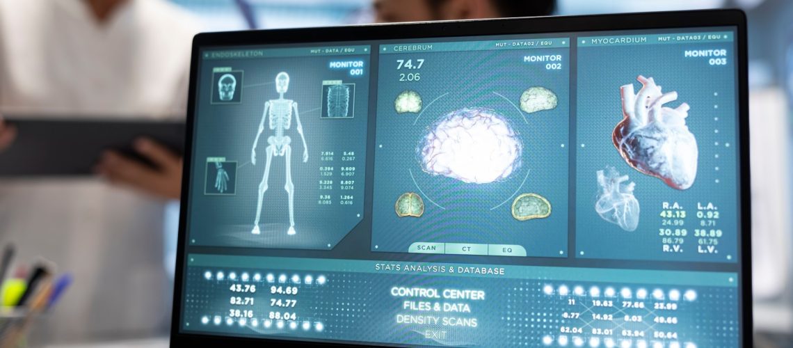Study: Detecting structural heart disease from electrocardiograms using AI. Image Credit: DC Studio / Shutterstock
