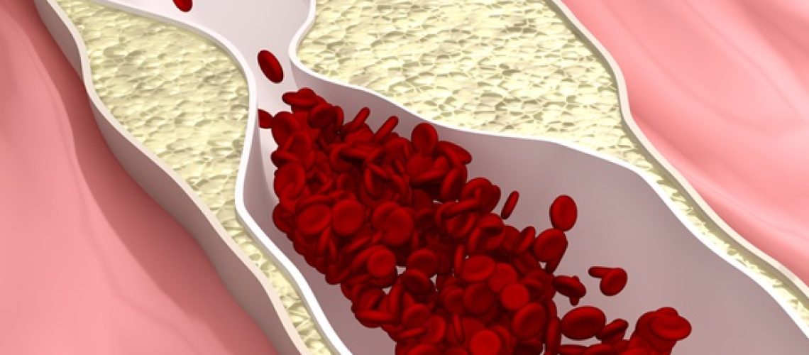 מודל גיליון כלי דם ננומטרי תלת מימדי לבדיקת תרופות טרשת עורקים בתפוקה גבוהה