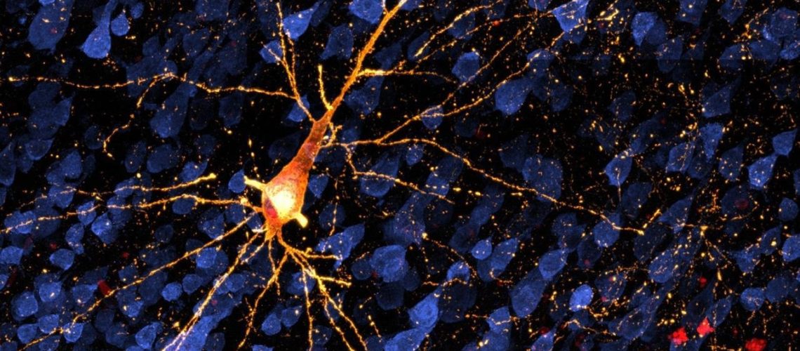 Nonhuman primate model reveals early-stage Alzheimer’s disease progression