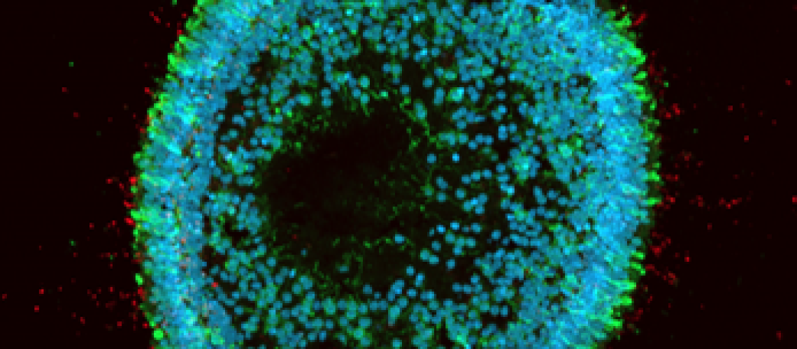 image of a retinal organoid