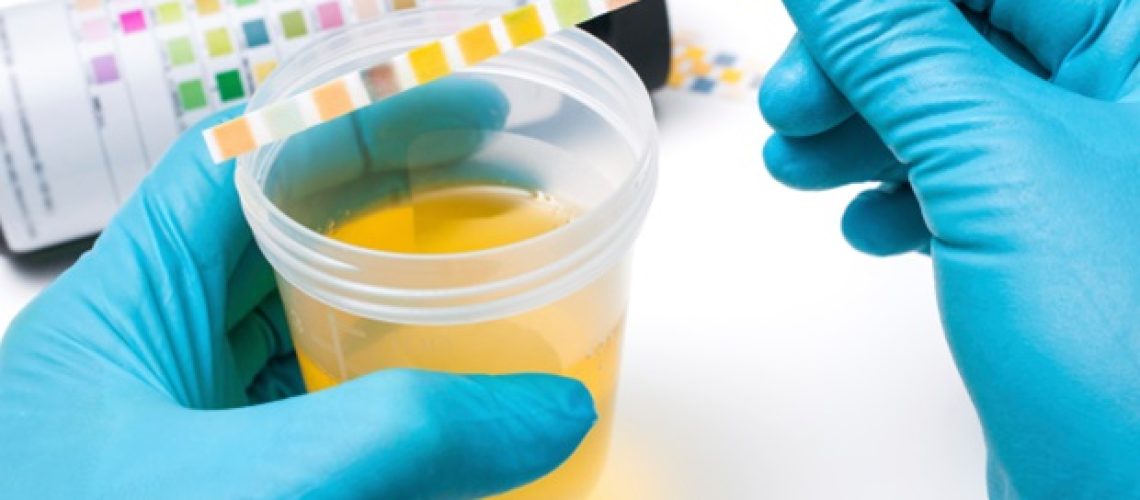 מחקר UCSF חושף הכפלה של פציעות ואשפוזים מכלי רכב ניידים