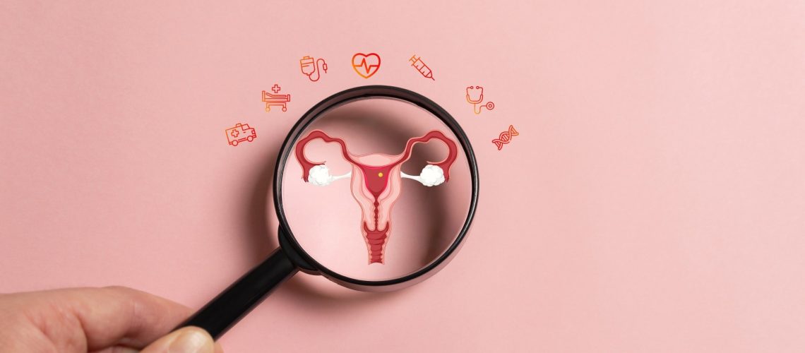 Study: Worldwide patterns and trends in ovarian cancer incidence by histological subtype: a population-based analysis from 1988 to 2017. Image Credit: simonizt / Shutterstock.com