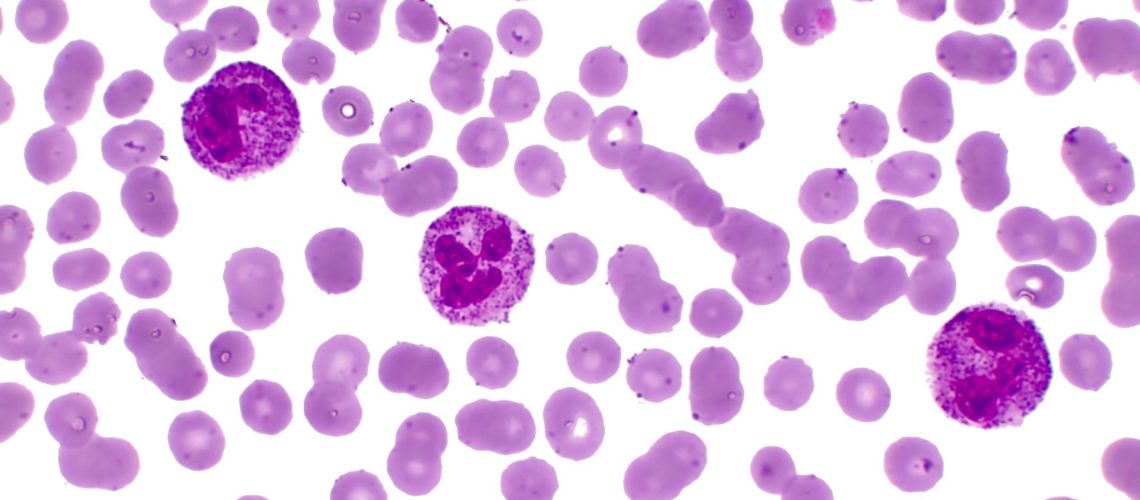 Study: Analysis of somatic mutations in whole blood from 200,618 individuals identifies pervasive positive selection and novel drivers of clonal hematopoiesis. Image Credit: BioFoto / Shutterstock