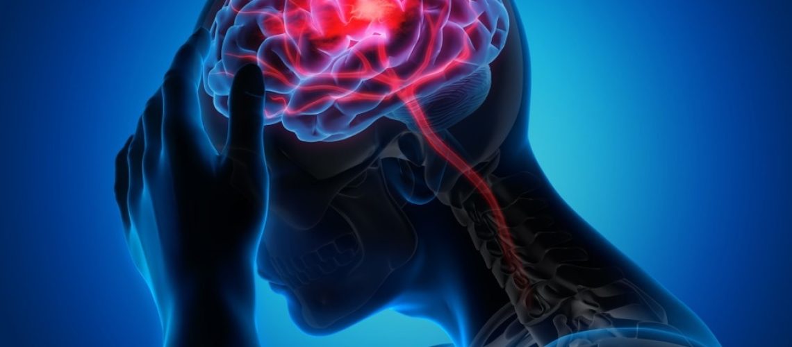 Study: Associations between dietary inflammatory index and stroke risk: based on NHANES 2005–2018. Image Credit: peterschreiber.media/Shutterstock.com