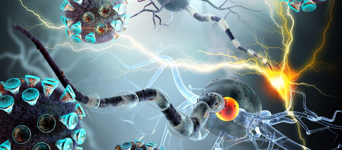 Study: ost-COVID cognitive deficits at one year are global and associated with elevated brain injury markers and grey matter volume reduction: national prospective study. Image Credit: Ralwell / Shutterstock