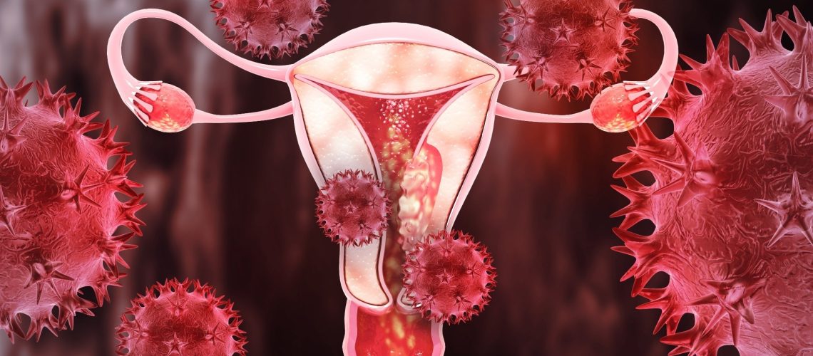 Study: Detection of endometrial cancer in cervicovaginal fluid and blood plasma: leveraging proteomics and machine learning for biomarker discovery. Image Credit: crystal light / Shutterstock.com