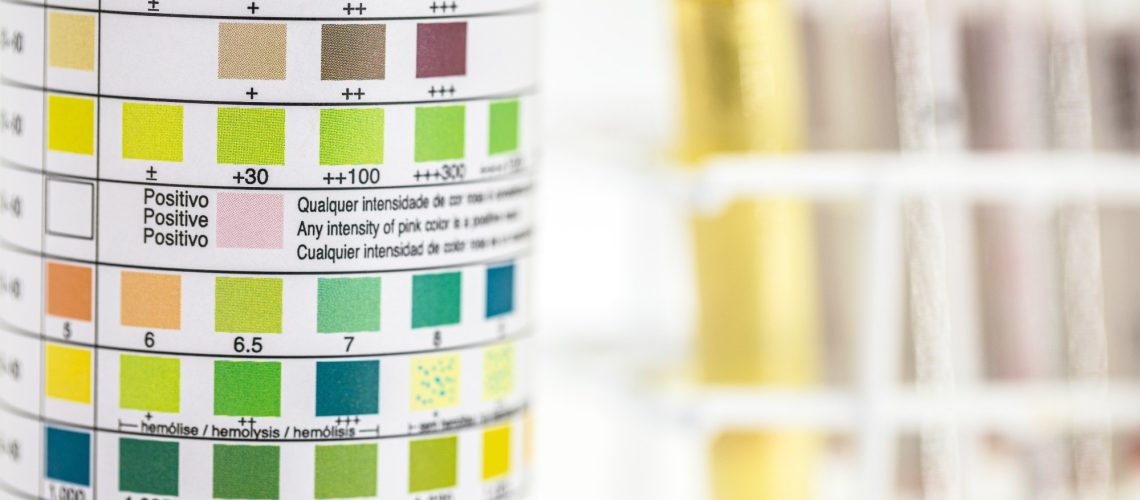 Study: Long-Term Fasting-Induced Ketosis in 1610 Subjects: Metabolic Regulation and Safety. Image Credit: RHJPhtotos / Shutterstock