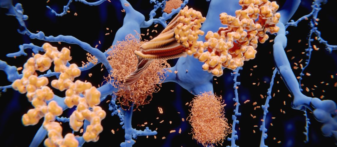 Study: Regulation of cell distancing in peri-plaque glial nets by Plexin-B1 affects glial activation and amyloid compaction in Alzheimer’s disease. Image Credit: Juan Gaertner / Shutterstock