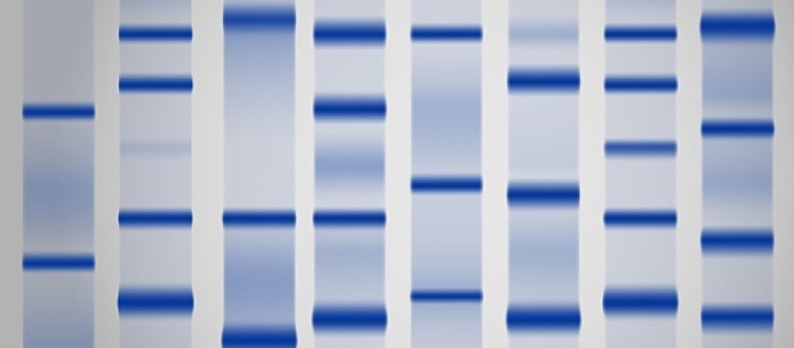 מחקר מדגיש את הקשר בין E. coli הפתוגני בשתן ובנרתיק בדלקת שלפוחית ​​השתן חוזרת