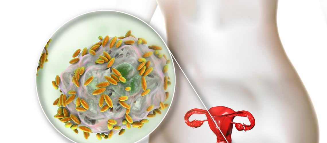 מחקר קושר מיני גרדנרלה מגוונים בנשים הרות לסיכון גבוה יותר ללידה מוקדמת