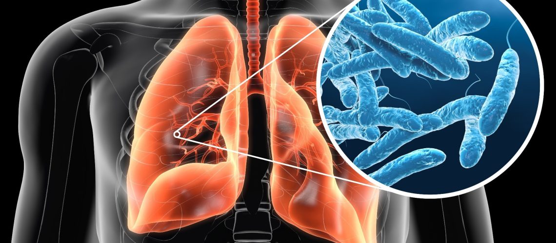 Study: Long-term impacts of Legionnaires’ disease on health and wellbeing: rationale, study design and baseline findings of a matched cohort study (LongLEGIO). Image Credit: Axel_Kock / Shutterstock