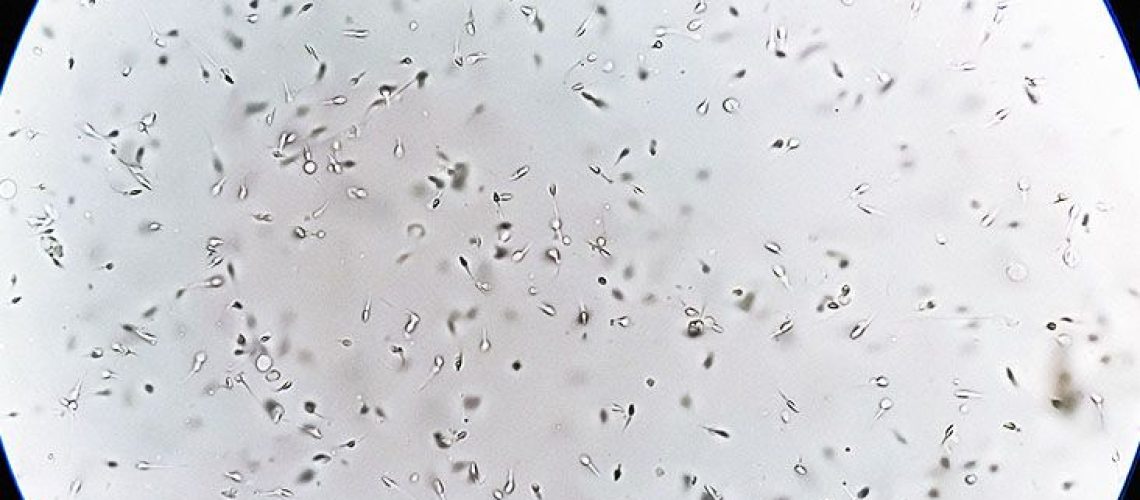 מיקרוביום זרע קשור לאי פוריות גברית, מגלה מחקר