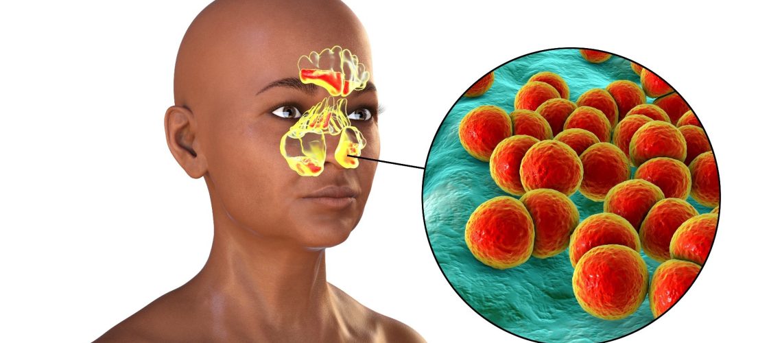 Study: Host and environmental factors shape upper airway microbiota and respiratory health across the human lifespan. Image Credit: Kateryna Kon / Shutterstock