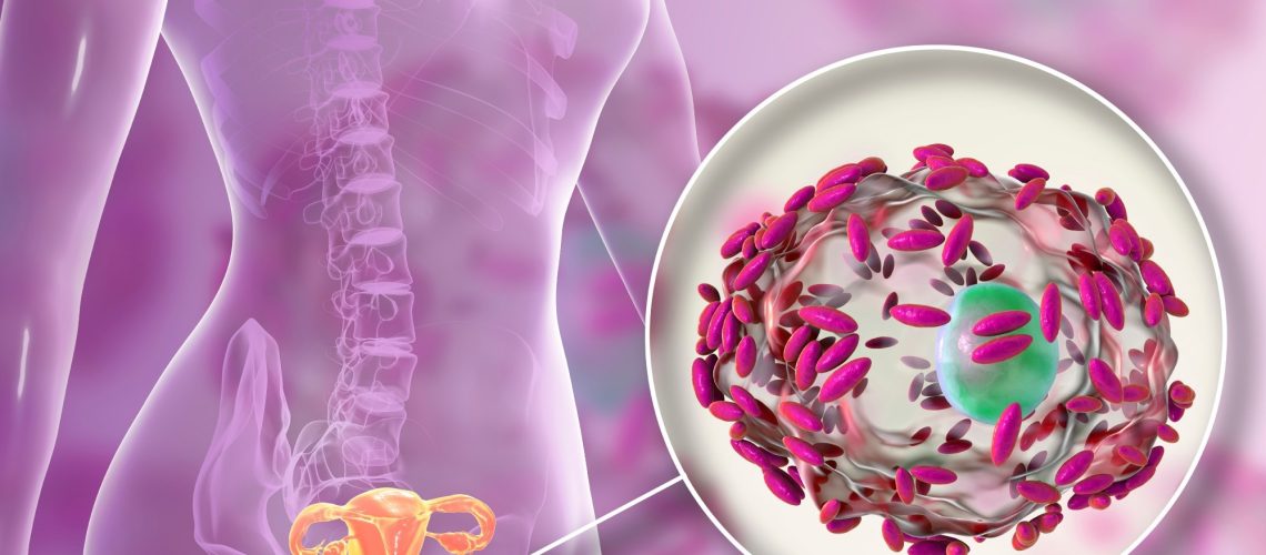 3D graphic of bacterial vaginosis