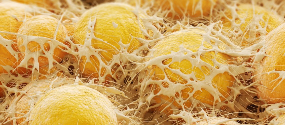 Human adipose tissue cells under a microscope