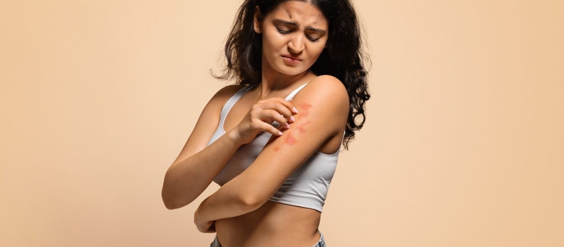 Study: Maternal stress triggers early-life eczema through fetal mast cell programming. Image Credit: Prostock-studio / Shutterstock