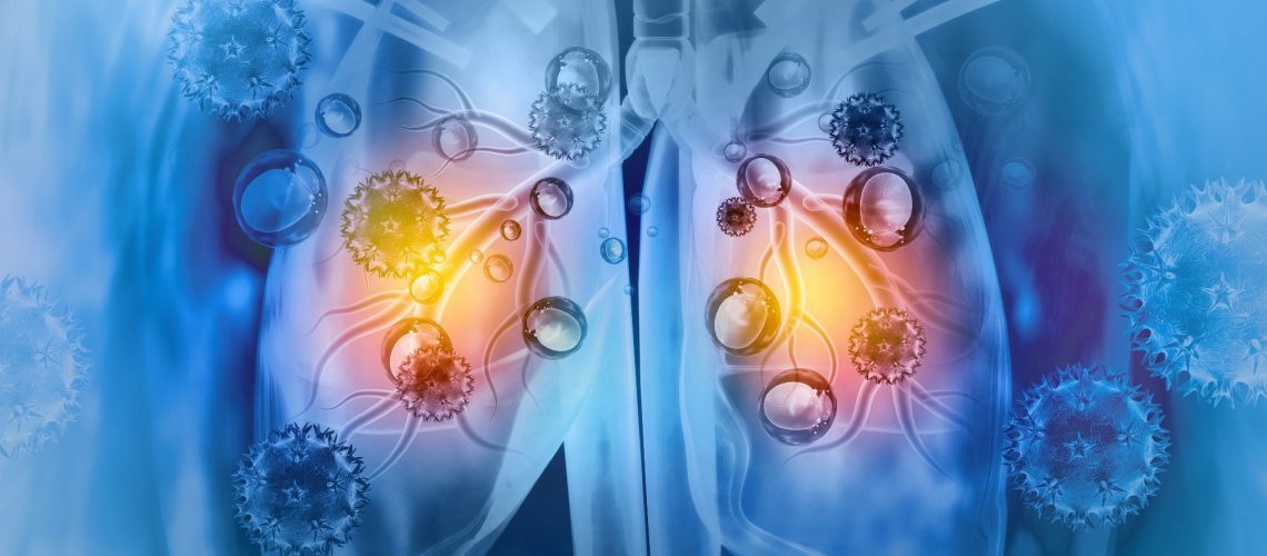 Study: Respiratory viral infections awaken metastatic breast cancer cells in lungs. Image Credit: crystal light / Shutterstock