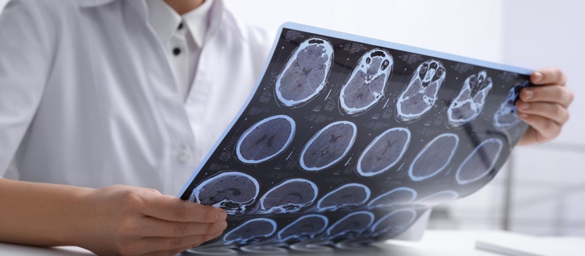 Study: Non-invasive stimulation of the human striatum disrupts reinforcement learning of motor skills. Image Credit: New Africa/Shutterstock.com