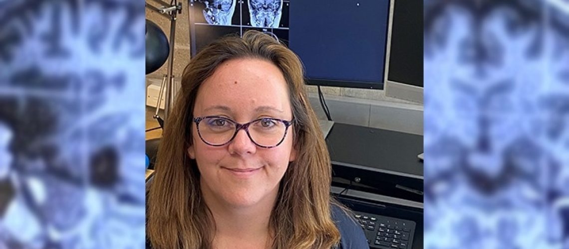 New research trial aims to address a disabling post-stroke condition