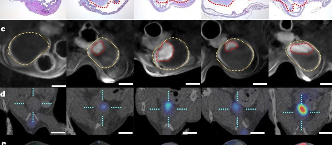 Study: Urease-powered nanobots for radionuclide bladder cancer therapy