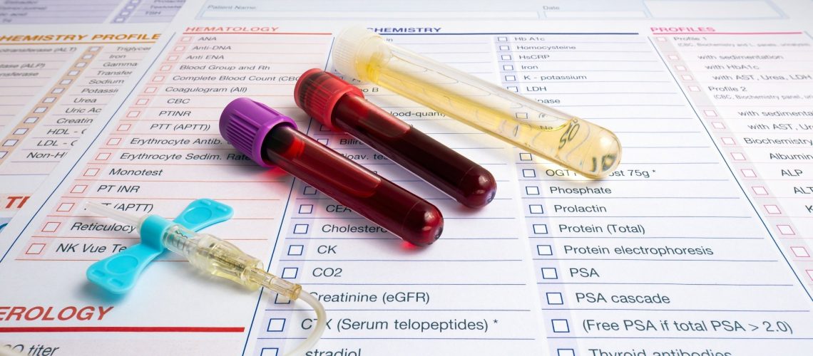 Blood tubes and urine of patient with test report for analysis in the Hematology lab.