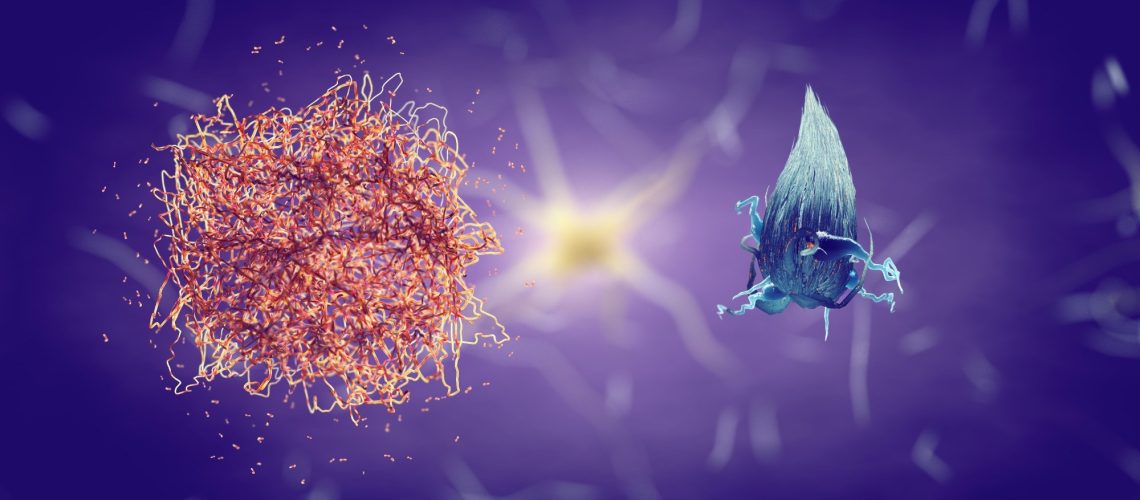 Study: Alzheimer disease blood biomarkers: considerations for population-level use. Image Credit: nobeastsofierce / Shutterstock