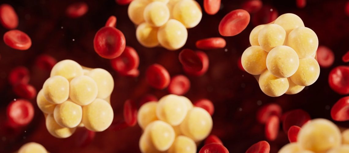 Study: Vitamin D Status and Atherogenic Lipid Profiles, Including Lipoprotein(a), in Elite Athletes. Image Credit: Vink Fan / Shutterstock