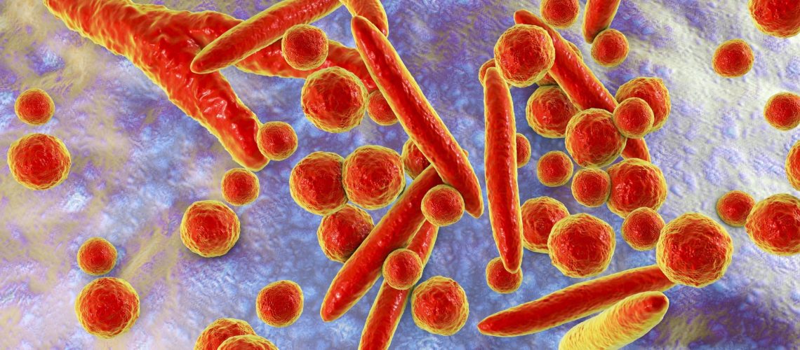 Rapid communication: Persistent elevation in incidence of pneumonia in children in England, 2023/24. Image Credit: Kateryna Kon / Shutterstock