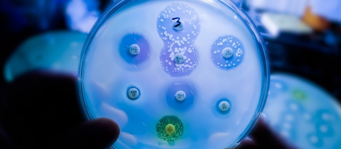 Antimicrobial susceptibility testing in petri dish.