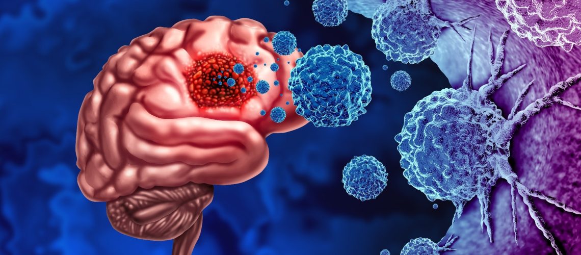 Review: Polyphenol-Based Nutritional Strategies Combined With Exercise for Brain Function and Glioma Control: Focus on Epigenetic Modifications, Cognitive Function, Learning and Memory Processes. Image Credit: Lightspring / Shutterstock