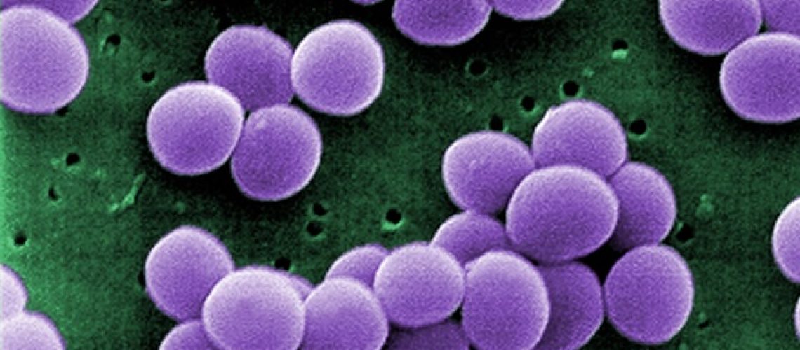 פלטפורמת ננו -חלקיקים חדשה פורצת דרך MRSA Biofilms