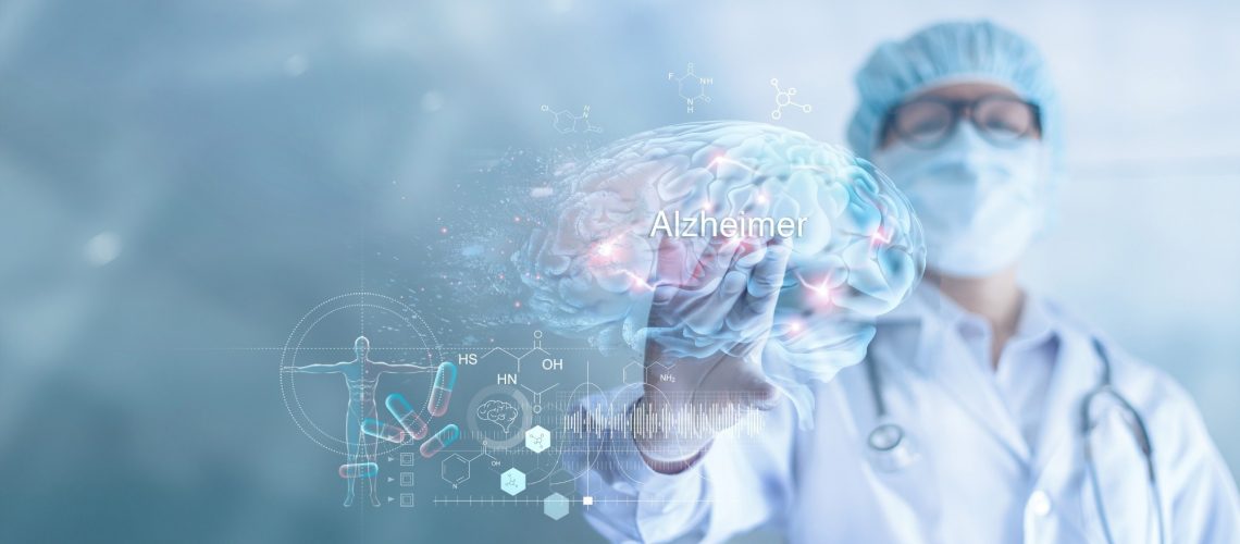 Study: Altering heparan sulfate suppresses cell abnormalities and neuron loss in Drosophila presenilin model of Alzheimer Disease. Image Credit: PopTika/Shutterstock.com
