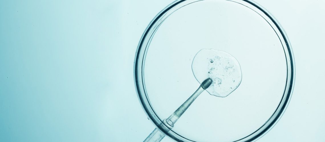 In vitro fertilization process with petri dish and pipette