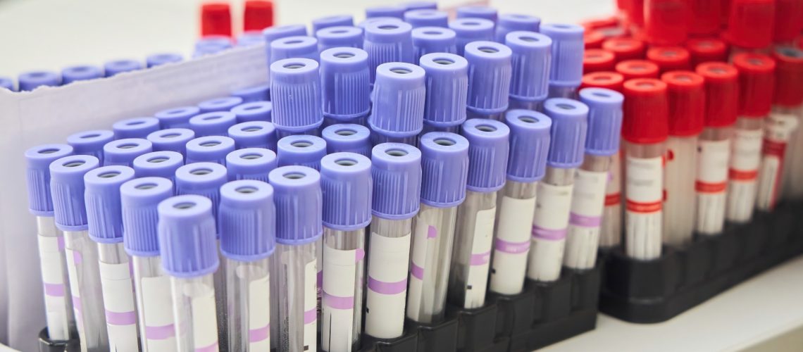 flasks for blood analysis