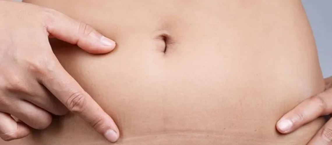 קולגן לא סדיר בצלקות הרחם הקשורות להתפתחות שליה