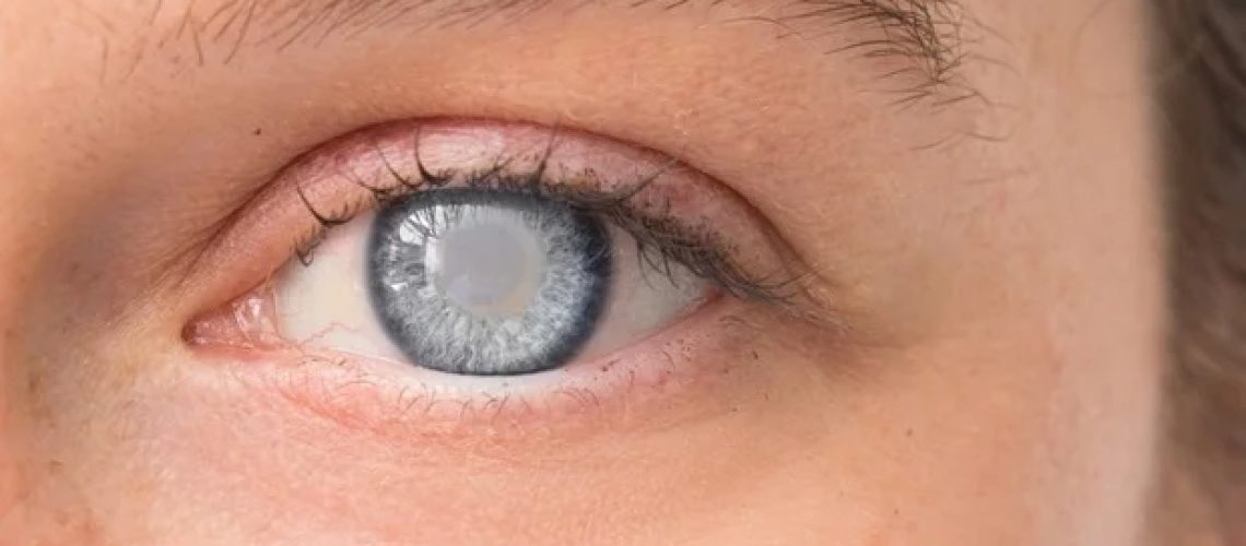 רופא עיניים הר סיני חושף כלי פורץ דרך לניטור נוזלי עיניים