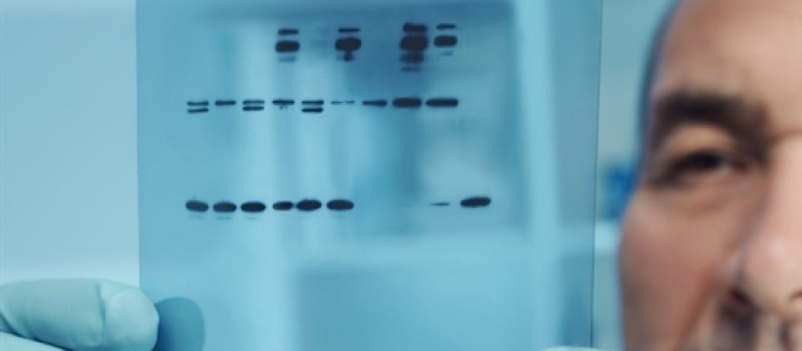 רמות PGE2 גבוהות מניעות שינויים בעור הקשורים לגיל וסיכון לסרטן