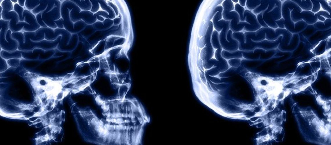 רמות גלוקוז גבוהות מדי או נמוכות מדי עלולות להאט את הקוגניציה אצל אנשים עם סוכרת מסוג 1