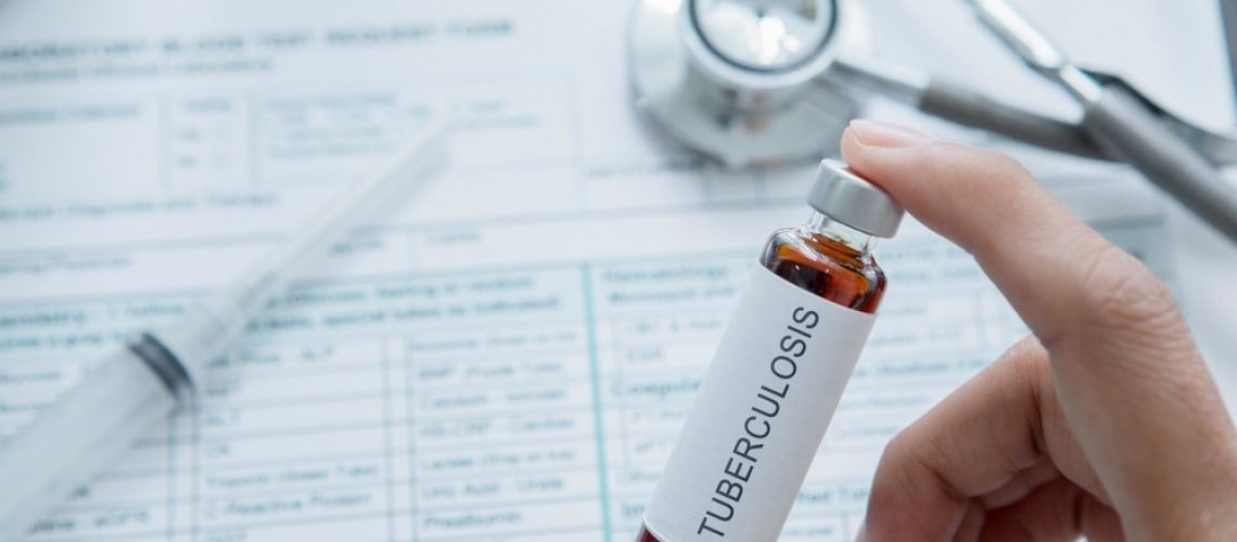 Hand of unknown female doctor holding a vial with tuberculosis written on it