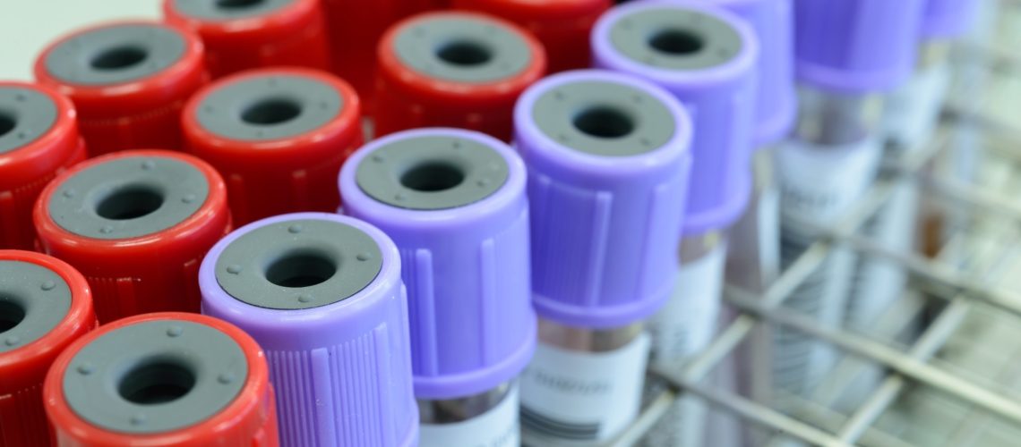 Study: Disease prediction with multi-omics and biomarkers empowers case–control genetic discoveries in the UK Biobank. Image Credit: Xray Computer/Shutterstock.com