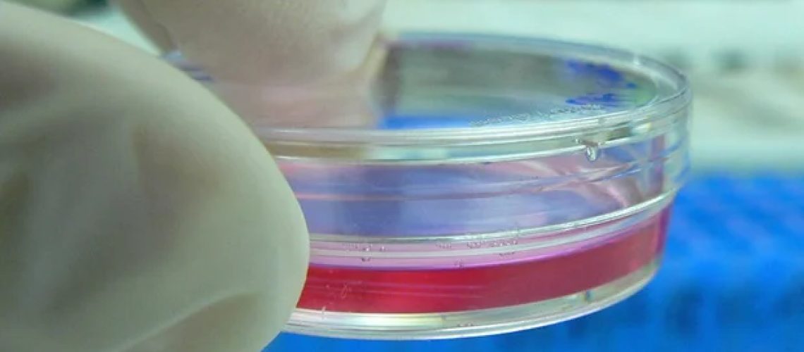 שכבות תאי מזנכימלי ואנדותל מהונדסים מחקים ביעילות בלוטות לימפה מקומיות