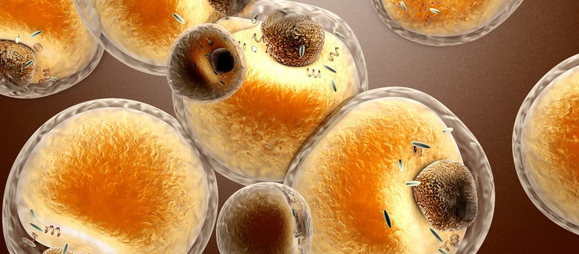 obesity-liked fat vesicles