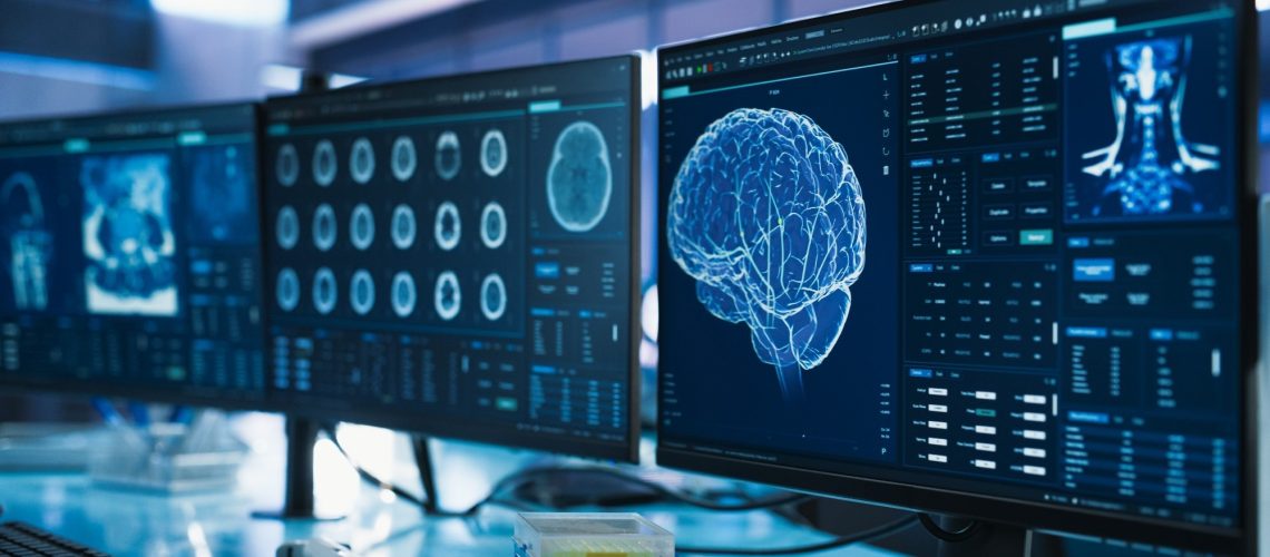 תאי חיסון פעילים שהתגלו במח עצם הגולגולת של המוח נלחמים בגליובלסטומות