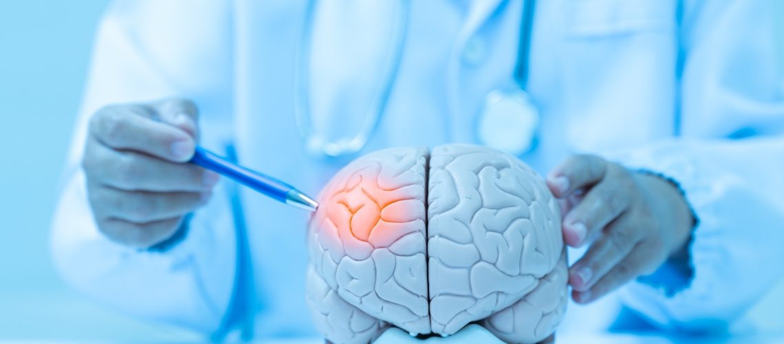 ​​​​​​​Study: Cognitive function in adolescence and the risk of early-onset stroke. Image Credit: Komsan Loonprom/Shutterstock.com
