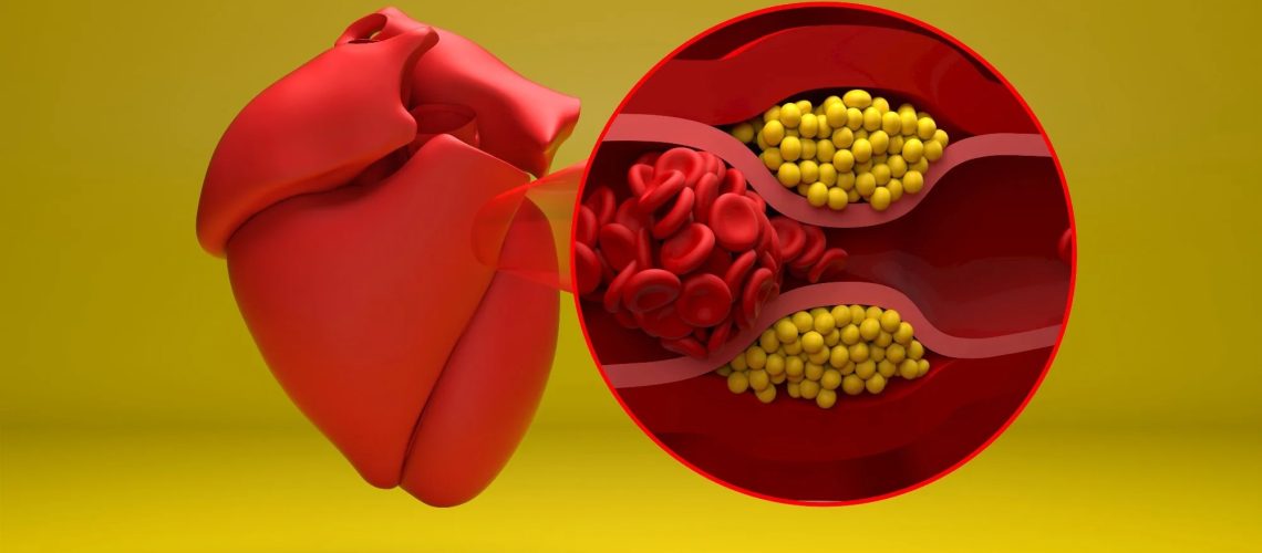 Study: Glucagon‐Like Peptide‐1 Receptor Agonists and Cardiovascular Events in Adults With Obesity and Autoimmune Disease: A Target Trial Emulation. Image Credit: Nemes Laszlo / Shutterstock