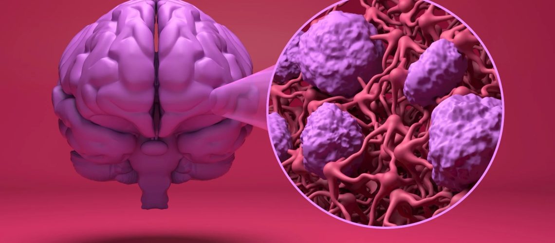 Study: Blood–brain barrier crossing of antihypertensives and risk of dementia: a comparative analysis. Image Credit: Nemes Laszlo / Shutterstock